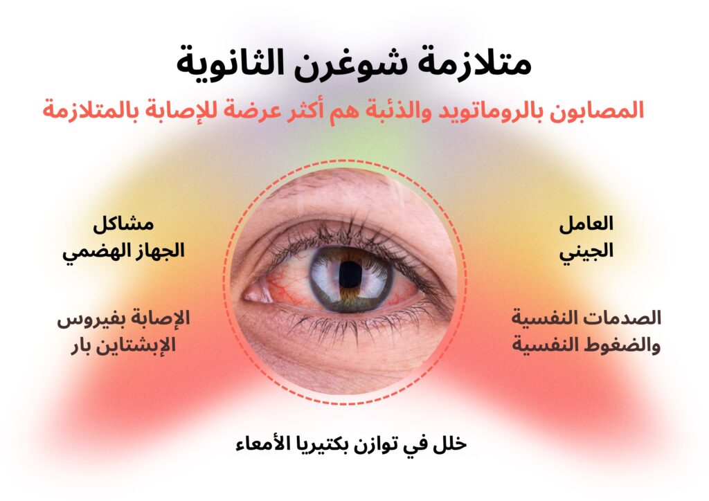 أسباب وعوامل خطر متلازمة شوغرن